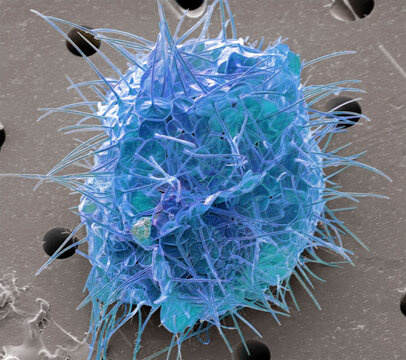Acanthocystis, SEM