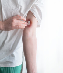 Bruise ointment: a step towards faster healing and skin recovery. A girl applies healing cream to a bruise, speeding up the recovery process.