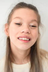 Portrait of disabled girl smiling at camera isolated over white background.