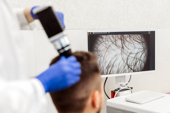 Trichoscopy of hair and scalp closeup. Trichoscope in the hands of a doctor. The concept: precise and professional approach to hair and scalp health diagnosis.