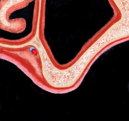 edentulous area of the first upper molar - anatomical section © brucekee