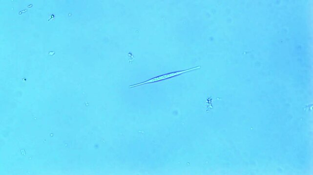 Freshwater diatom gliding - 400X magnification