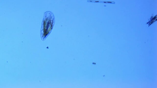 Frontonia; Ciliated protozoa swims in freshwater