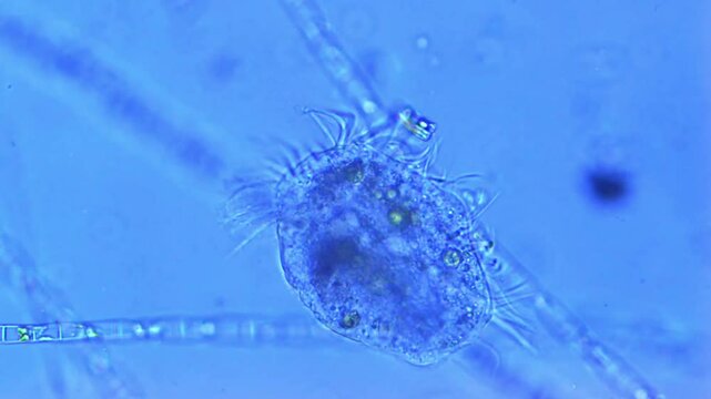 Hypotrich - ciliated protozoa - lyses under microscope - 400X magnification