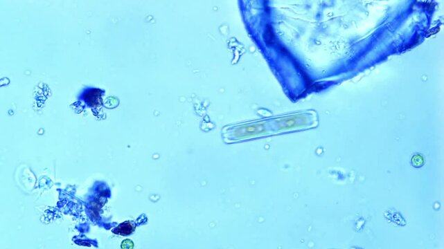 Diatom glides in freshwater - 400X