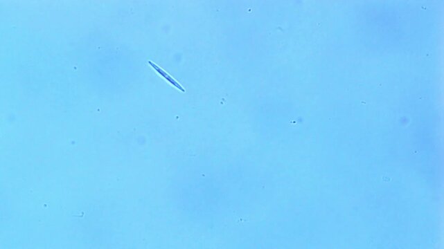 Freshwater diatom gliding under microscope - 400X