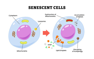 Senescent cells process, labeled cytoplasm, mitochondria, lysosome, dysfunction of mitochondria, accumulation of metals, SASP, lipid droplets, disrupting of autophagy. Biology education.