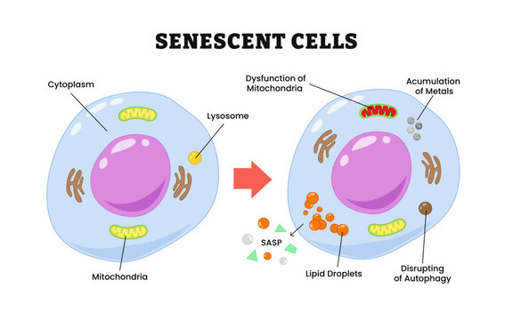 Senescent cells process, labeled cytoplasm, mitochondria, lysosome, dysfunction of mitochondria, accumulation of metals, SASP, lipid droplets, disrupting of autophagy. Biology education.