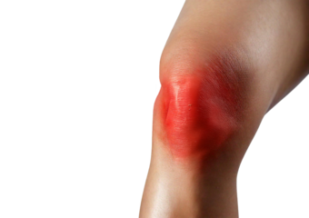 Inflamed knee (Turns slightly red). isolated on transparent or white background