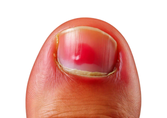 Inflamed toe (Turns slightly red) isolated on transparent or white background