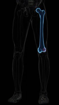 Avulsion Fracture in Vertical HQ Video | X-ray video showing a Avulsion fracture