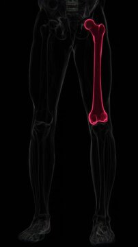 Avulsion Fracture in Vertical HQ Video | X-ray video showing a Avulsion fracture in HQ