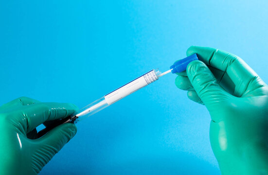 The doctor's hands are holding a gloved urological probe with a study of androflora to identify pathogenic microflora, staphylococcus and enterococcus. Copy space for text, microscopy