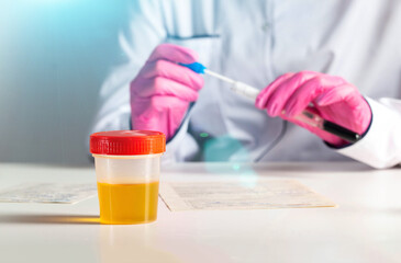 Doctor laboratory assistant in pink gloves performs research against the background of urine analysis. Concept of testing urine for sand and hematuria. Kidney disease. Copy space for text
