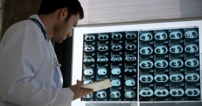 Doctor standing with laptop examine x-ray flim for patient in the hospital.