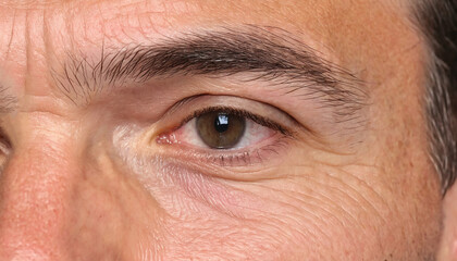 Closeup of man eye wrinkles with wrinkles, crow's feet at the corners of eyes and horizontal forehead line, generative AI.