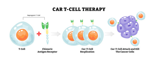 Car T-cell Therapy process diagram, healthcare poster design, cancer immunotherapy. killing of tumor cells. genetically engineered, labeled chimeric antigen receptor, replication, cancerous cell.
