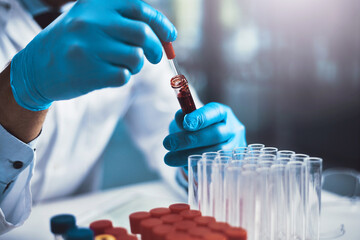 Vial, test tube and hands of scientist with pipette for medical research, dna testing or rna...