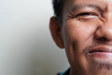 Close-up of a Person Smiling with Dimples and Crinkled Eyes