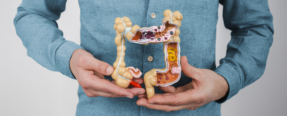 Man suffering from constipation and abdominal pain. Treatment of colitis, flatulence, indigestion