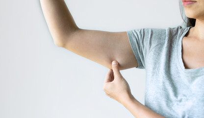 Closeup of young Asian woman pinching arm fat flabby skin, Female pulling excess fat on white background. Beauty, liposuction and confident for bodycare or weight loss concept. Copy space