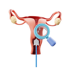 Pap smear check. 3d illustration