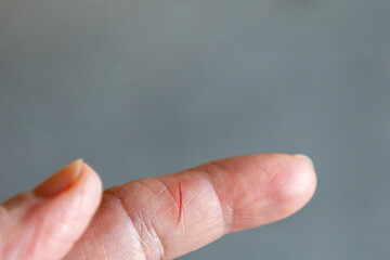 A detailed close-up of a human finger with a small fresh cut on the skin.
