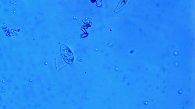 Flagellated protozoa in freshwater - 400x magnification
