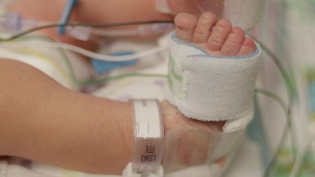 Closeup of a Newborn Babys Foot at the NICU