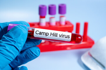 Obraz premium A new pathogen, called Camp Hill virus, was recently discovered in Alabama, drawing attention to a group of viruses known as henipaviruses