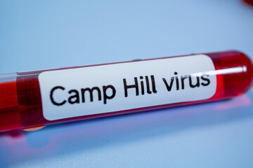 Obraz premium A new pathogen, called Camp Hill virus, was recently discovered in Alabama, drawing attention to a group of viruses known as henipaviruses