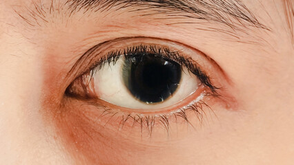 Obraz premium Close-Up Detail of Indonesian Woman's Eye Showing Iris and Eyelashes