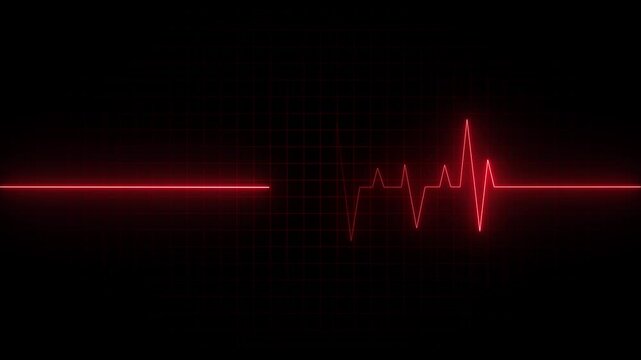 Cardiogram heartbeat line animation. seamless loop animated motion. heartbeat rate video. Emergency ekg video. - Powered by Adobe