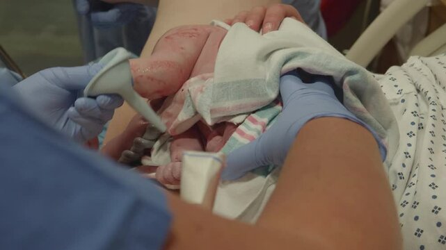 New Born Baby just born and Getting suctioned