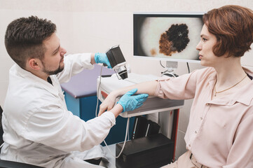 Male doctor examines neoplasms or moles on the woman patient's skin - using special apparatus for...