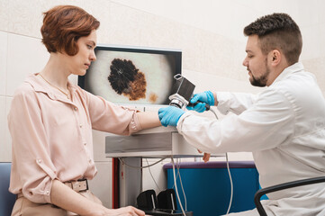 Male doctor examines neoplasms or moles on the woman patient's skin - using special apparatus for...