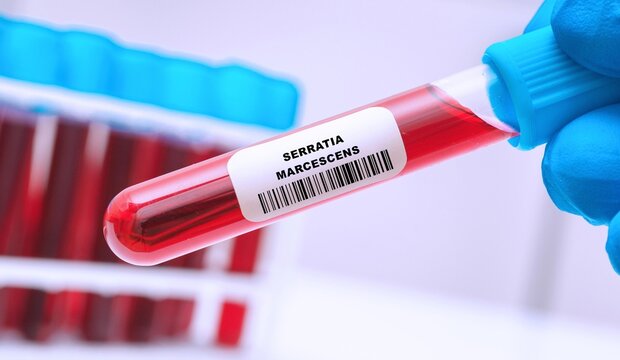 Serratia marcescens