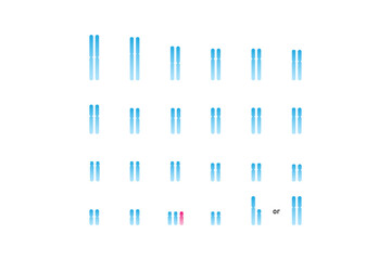 Trisomy 21 Syndrome Science Design. Vector Illustration.