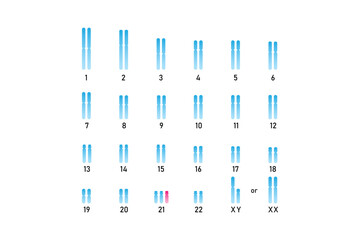 Trisomy 21 Syndrome Science Design. Vector Illustration.