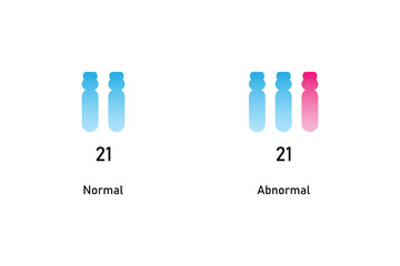 Trisomy 21 Syndrome Science Design. Vector Illustration.