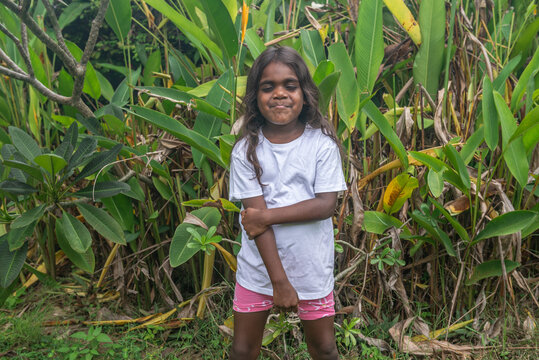 Sore 4 yo aboriginal child holding arm
