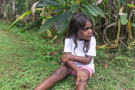 Sore 4 yo aboriginal child with hand holding knee and elbow