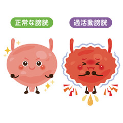 正常な膀胱と過活動膀胱のキャラクターイラスト
