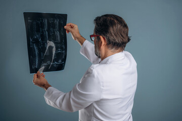 X-ray in hands of a doctor. Senior man is standing in the studio against background