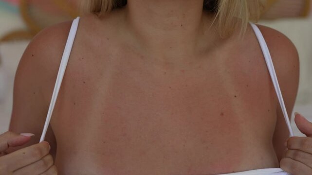 Close-up of a young tanned blonde woman showing off her tan on the chest by lifting up strap of swimsuit. The result of tanning. Tanned skin, contrast of skin colors. White traces of swimwear