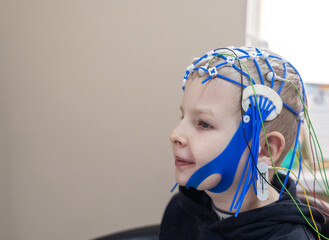A boy's brain is examined on an EEG machine. Electroencephalogram is performed in a hospital laboratory to detect neurological diseases. Encephalogram for children
