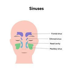 Sinuses anatomy. Nose nasal anatomy. Inflammation Nasal Cavity