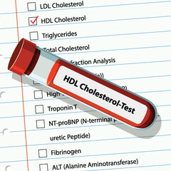 Fototapeta premium HDL Cholesterol Test Illustration