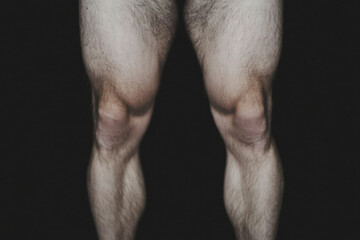 A man with hairy legs and knees
