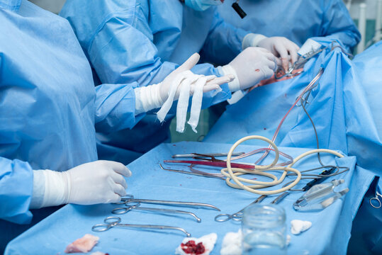 Otolaryngologist performs tonsillectomy, removal of tonsils, ENT. septoplasty, maxillofacial surgery.An array of medical instruments and hoses is visible, indicating a sterile surgical environment. 